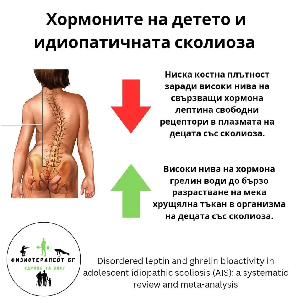 сколиоза